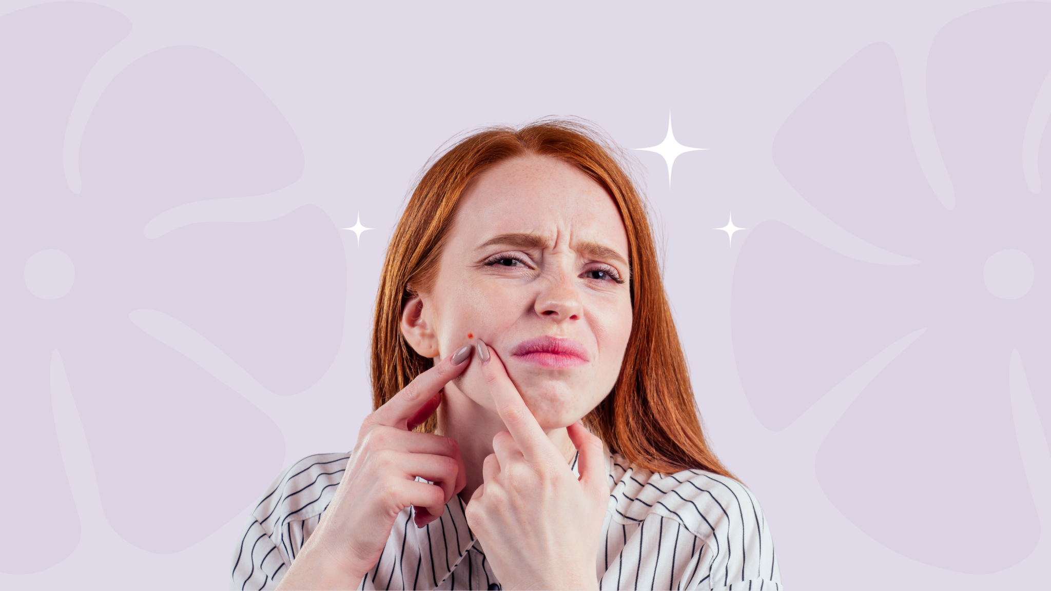 young women squeezing a spot on her face and wondering if she should use a pimple patch